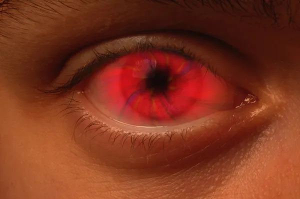 Red Vortex in an eyeball