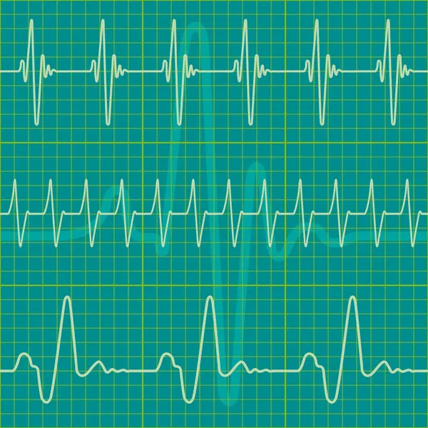 Cardiograma — Vetor de Stock
