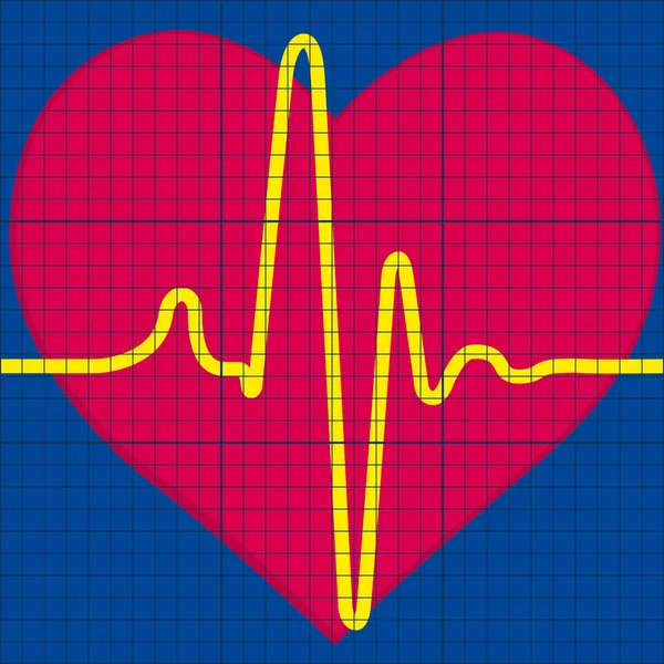 Cardiograma — Vector de stock