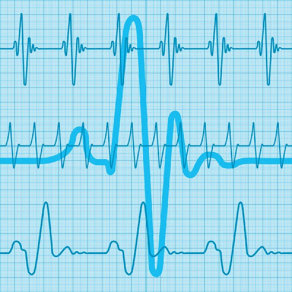 Cardiograma — Vetor de Stock