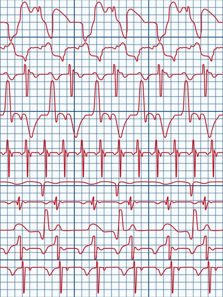 Cardiogramma — Vettoriale Stock