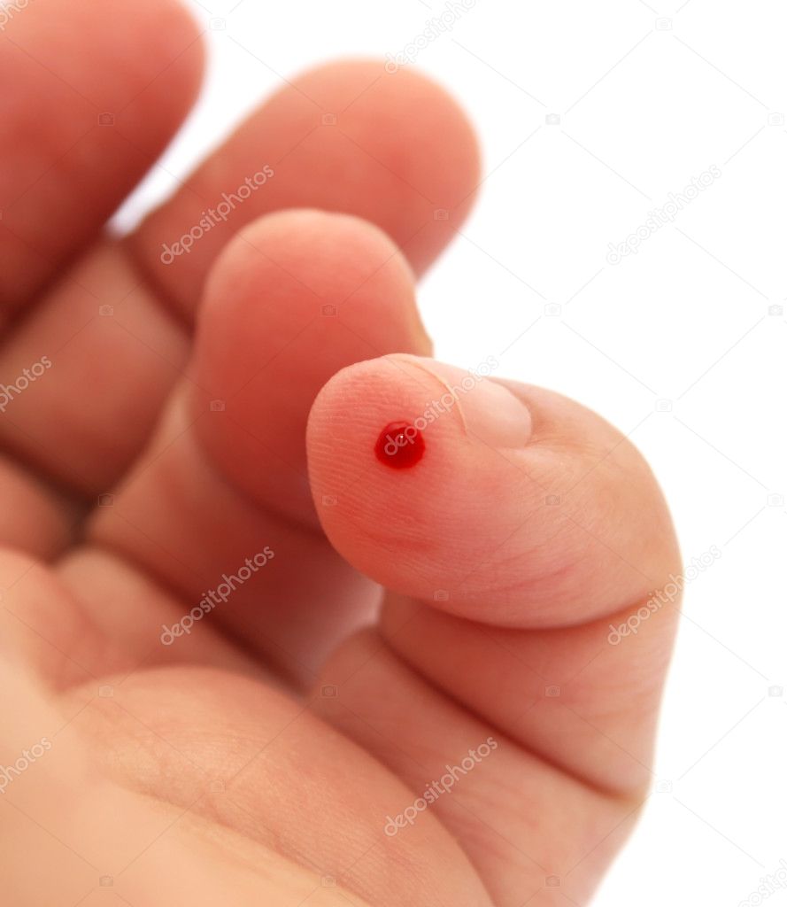 Bleeding finger