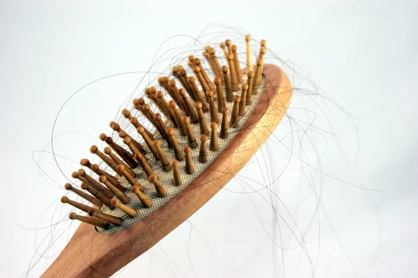 Выпадение волос -2 — стоковое фото