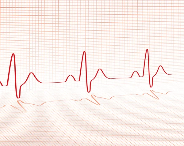 Batimento cardíaco grade vermelha — Vetor de Stock