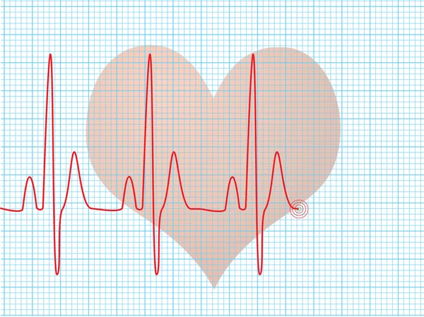 Latidos cardíacos médicos — Vector de stock