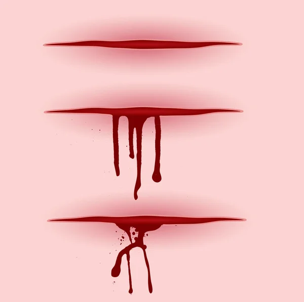 血切 — 图库矢量图片