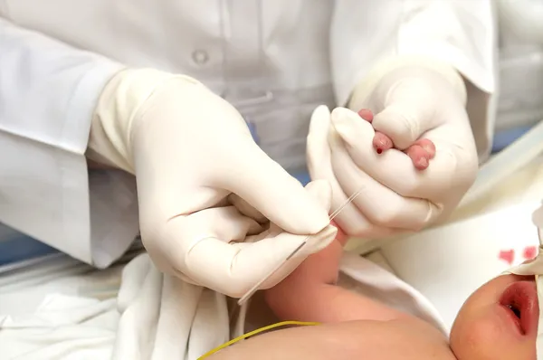 新生児の血液検査 — ストック写真
