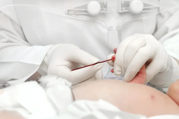 新しく生まれた子どもの採血 — ストック写真