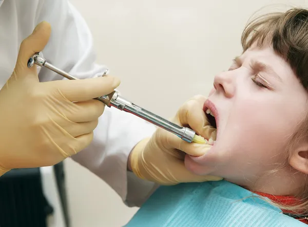 Инъекция стоматологической анестезии — стоковое фото