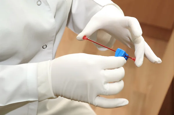 혈액 검사 메 딕 장비 — 스톡 사진