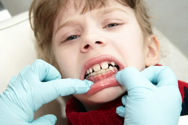 Bij tandarts medic orthodontische arts onderzoek — Stockfoto