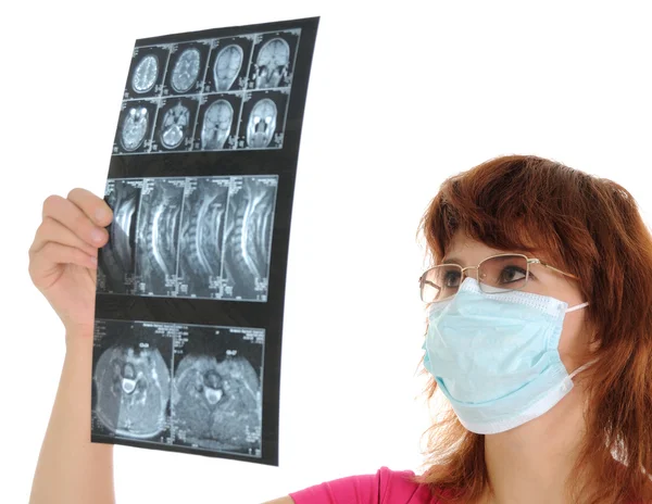Kvinnliga läkare med tomogram — Stockfoto