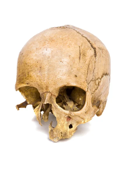 stock image Human Scull