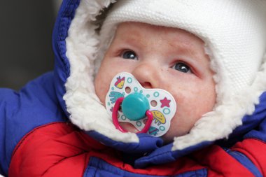 Infant has eczema on his face clipart