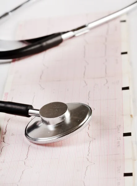 Stethoscoop op de cardiogram — Stockfoto