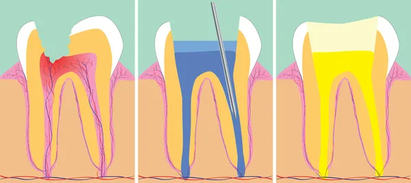 Dentisterie — Image vectorielle