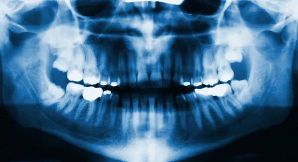 Röntgen des Gesichts — Stockfoto