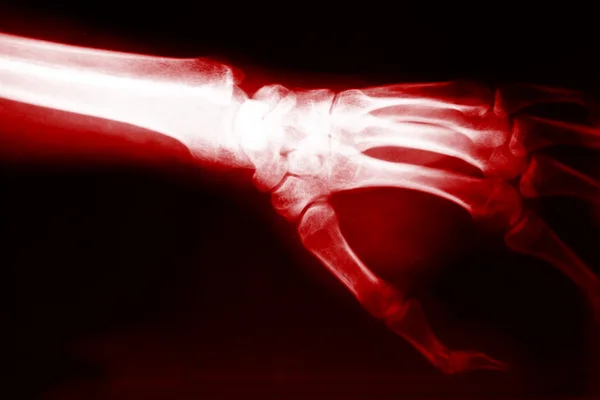 Рентген рук — стоковое фото
