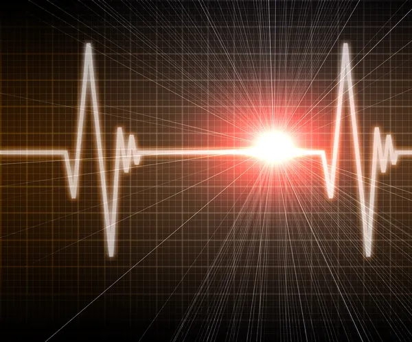 Kalp hızı görüntü — Stok fotoğraf