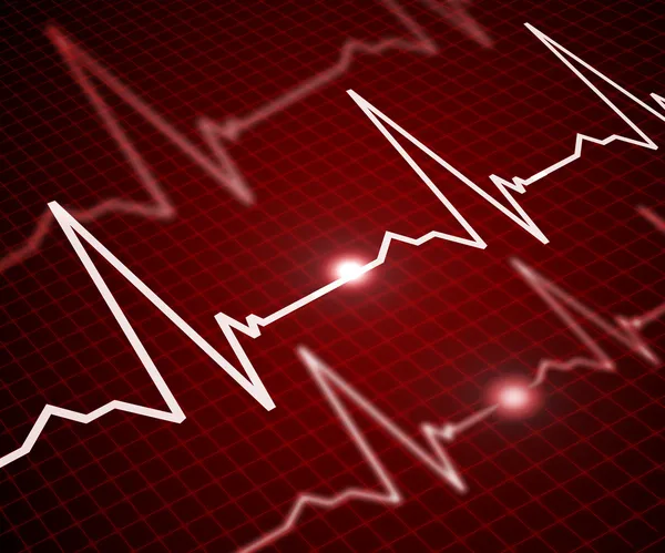 Imagen de la frecuencia cardíaca — Foto de Stock
