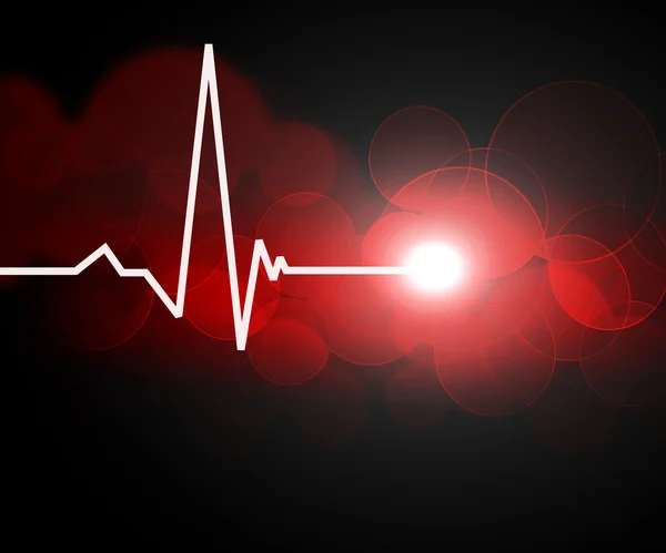 Obrázek srdeční frekvence — Stock fotografie