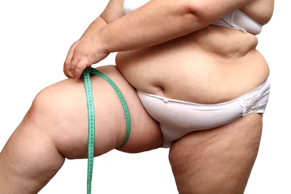 Donna in sovrappeso misurare la gamba — Foto Stock