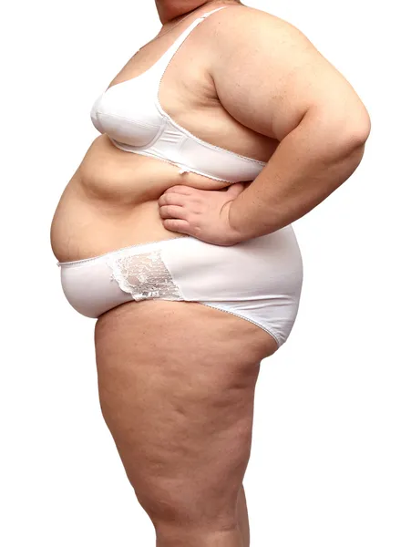 Överviktig kvinna kropp i underkläder — Stockfoto