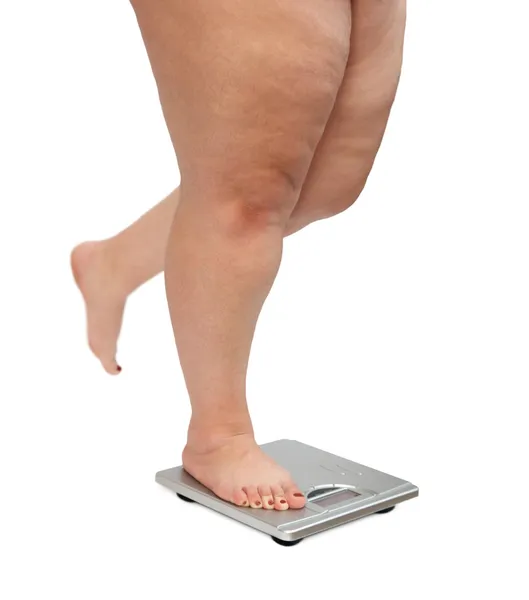 Mujeres piernas con sobrepeso — Foto de Stock