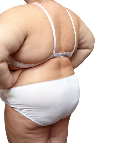 Excesso de peso corpo de mulher em roupa interior — Fotografia de Stock