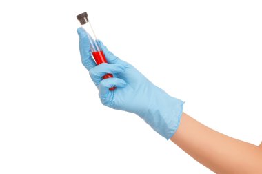 Blood test clipart