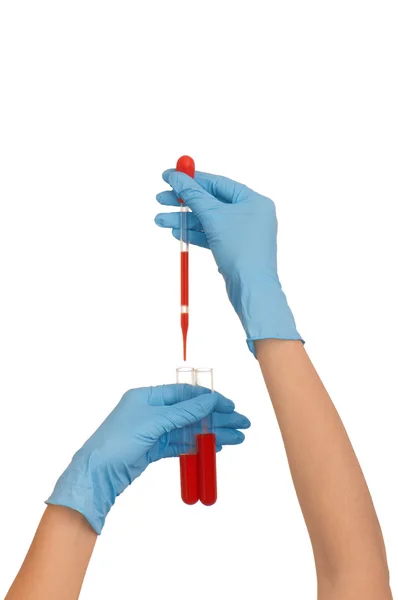 혈액 검사 — 스톡 사진