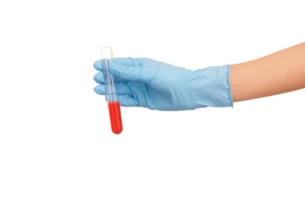 Анализ крови — стоковое фото