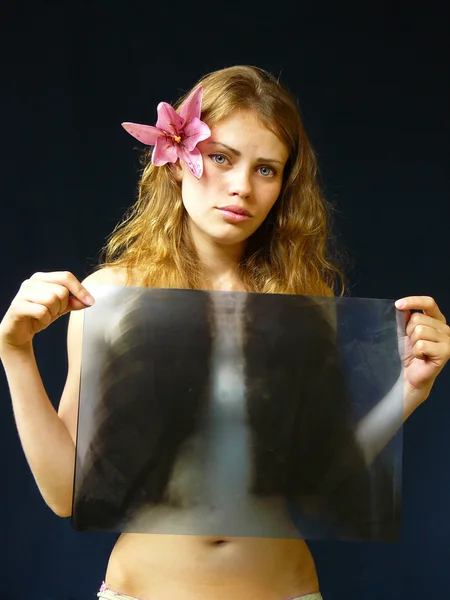Девушка с ренгеномом в руках — стоковое фото