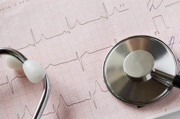 Cardiogram and stethoscope — Stock Photo, Image