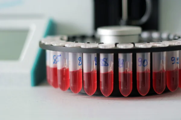 Teste de sangue — Fotografia de Stock