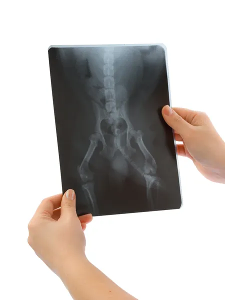X-ray in hands — Stock Photo, Image