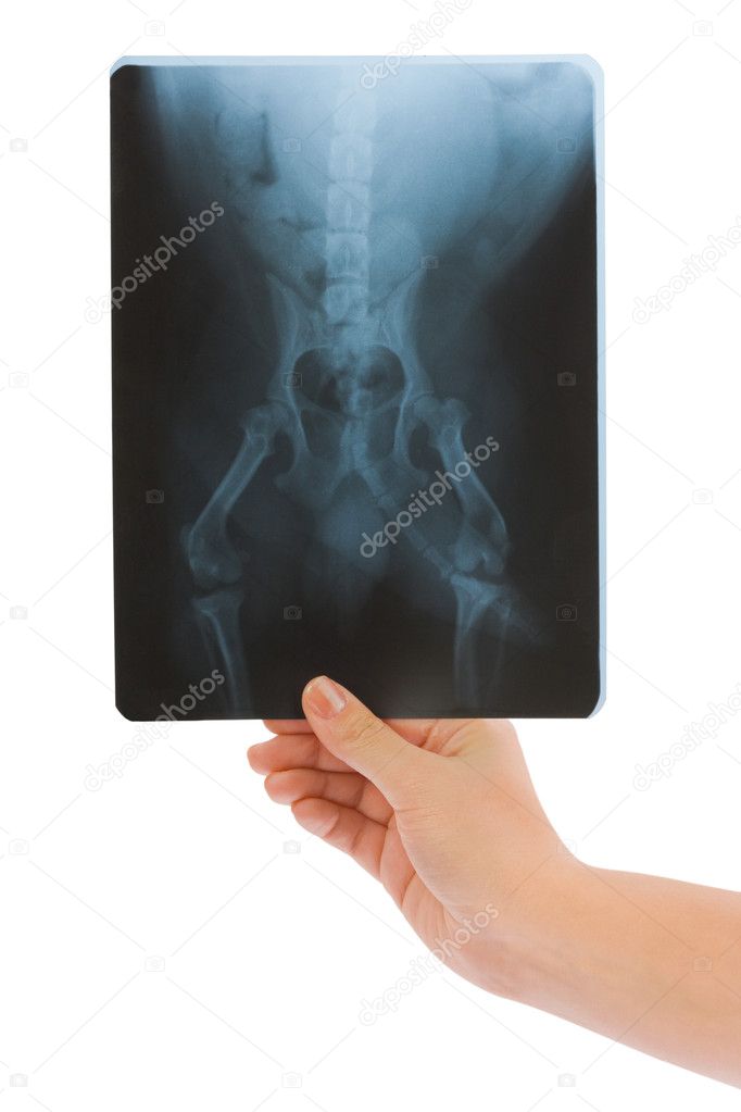 X-ray in hand
