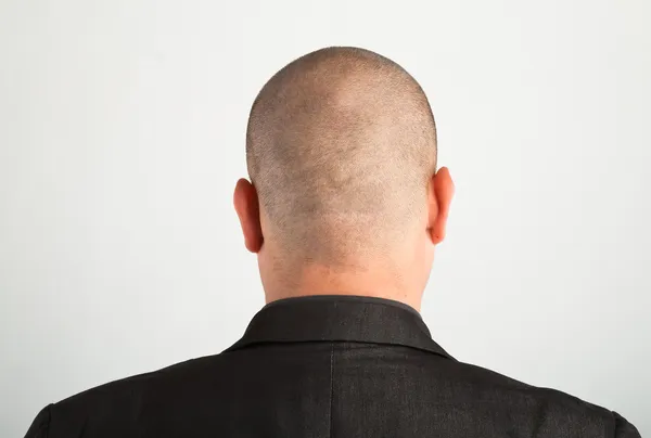 Rückseite des männlichen Kopfes — Stockfoto