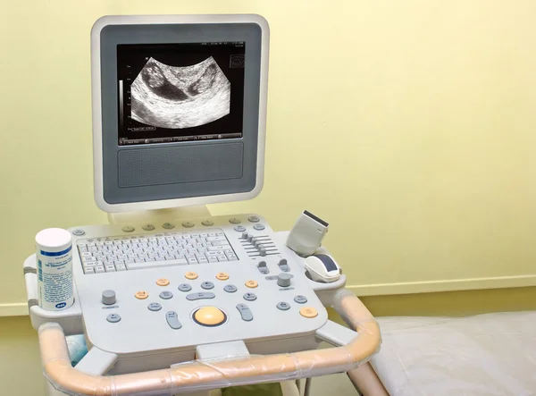 stock image Ultrasound machine