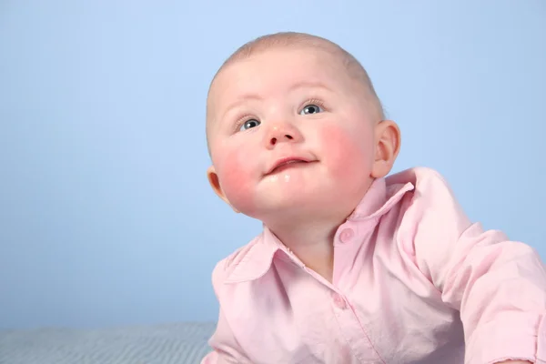 Cara de bebé con mejilla roja — Foto de Stock