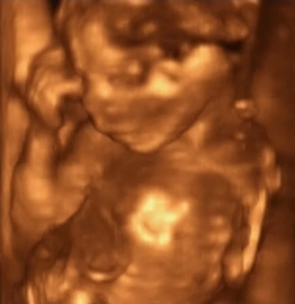 Üç boyutlu ultrason — Stok fotoğraf