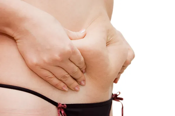 Flicka med en cellulit på en mage — Stockfoto