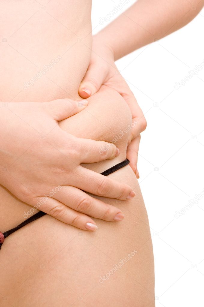 Girl with a cellulitis on a stomach