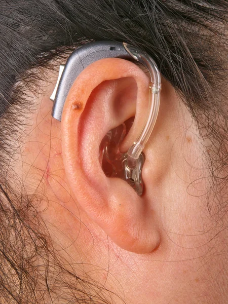 Kobieta sobie aparat słuchowy — Zdjęcie stockowe