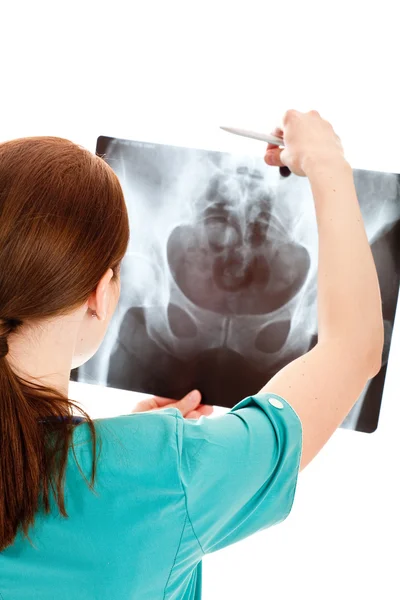 Medico femminile che esamina un'immagine a raggi X — Foto Stock