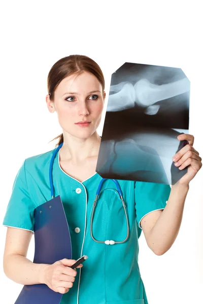 Médico feminino olhando para imagens de raios X — Fotografia de Stock
