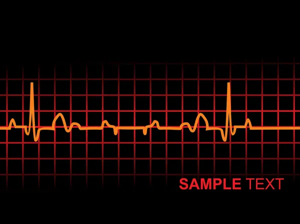 Lifeline in an electrocardiogram — Stock Vector