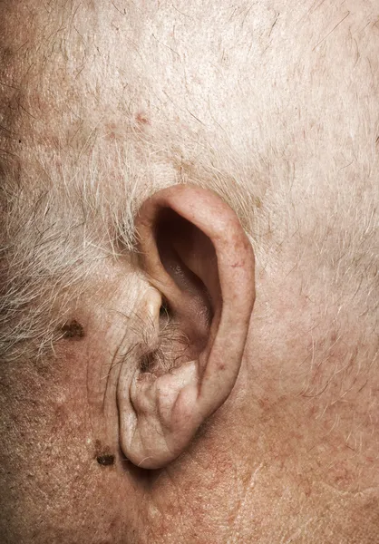 Yaşlı Adamın Kulağını — Stok fotoğraf