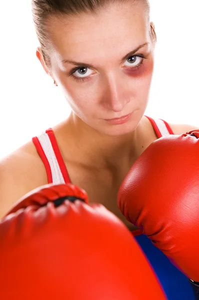 Woman boxer with a bruise on her face — Stock Photo, Image