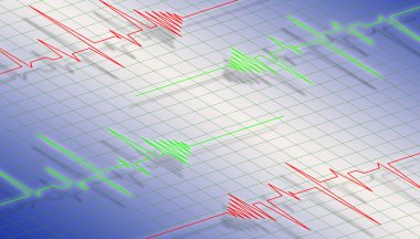 EKG diyagramı